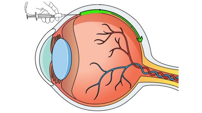 injecting genes into eyes