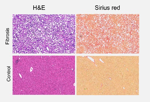 An image of four colored liver stains, purple, pink, orange, and peach.