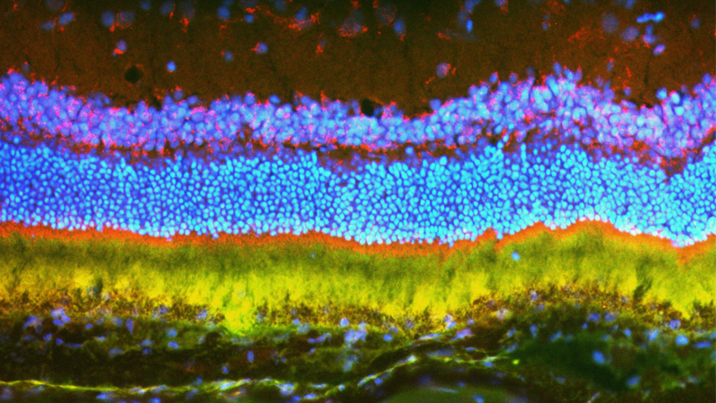 Newswise: Nanoparticles enhance gene therapies for eye disease