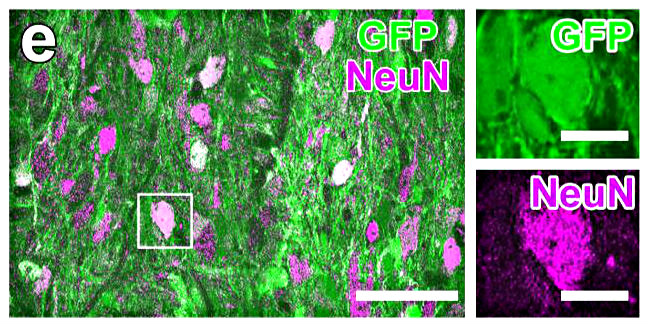 green neural stem cells differentiate into purple neurons