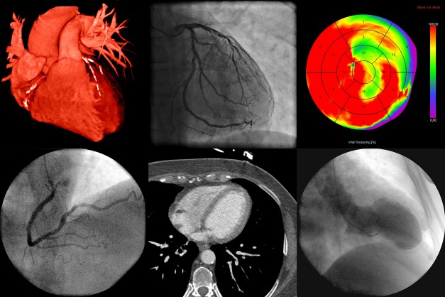 collage of heart images