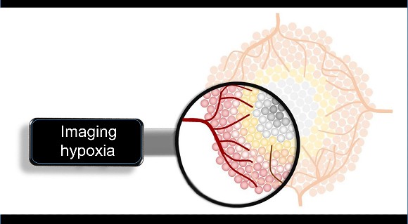 A computer generated image of a tumor with blood vessels and the words "imaging hypoxia"