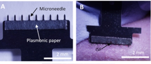 microneedle patch collects fluid from skin for diagnostic testing