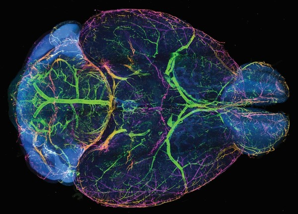 An image of a mouse brain with the vasculature stained with green and pink