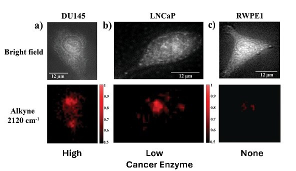 The top three panels show cells as viewed via bright-field microscopy, which shows the shape and size of the cells, but does not provide information on the amount of the legumain protein. The bottom three panels show cells as viewed via Raman spectroscopy, which has different amounts of red based on how much legumain is present.