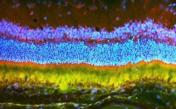 Protein expressed in the photoreceptors and retina of a rat. Image appears as fluorescent layers of red, purple, blue, yellow, and green.