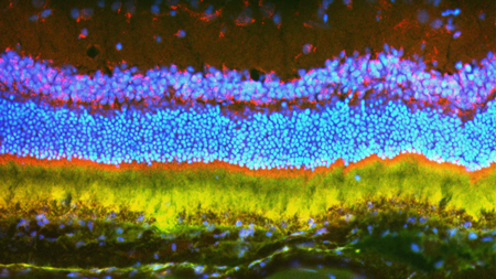 expression of transgene in eye retina