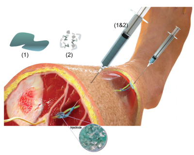 Injectrode concept - syringe injecting grey liquid into arm