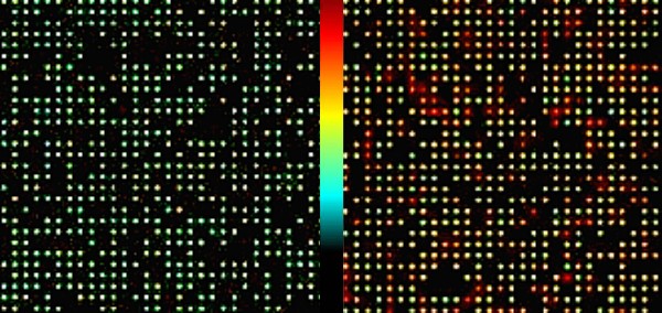 grid containing normal and cancer breast cells