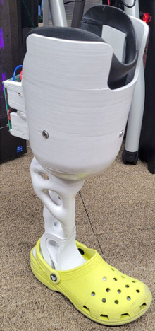 A photo of a prosthetic leg with an adjustable prosthetic socket