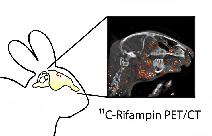 PET image of a rabbit brain following injection antibiotic, rifampin. Orange dots represent limited concentration of rifampin that penetrates the blood brain barrier and reaches TB lesions in the brain.