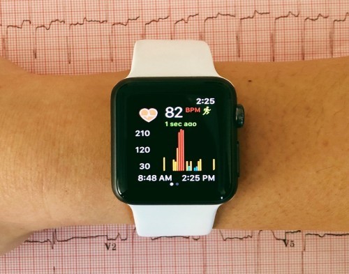 Reloj inteligente monitorea afecciones cardíacas