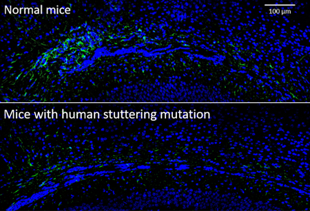Two images comparing normal and stuttering mice and importance of brain cells called astrocytes