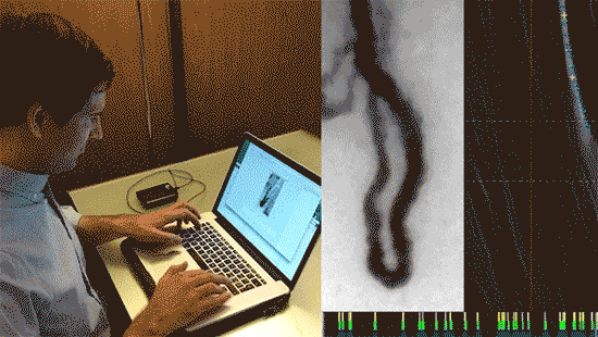 monitoring white cells in capillaries monitoring white cells in capillaries