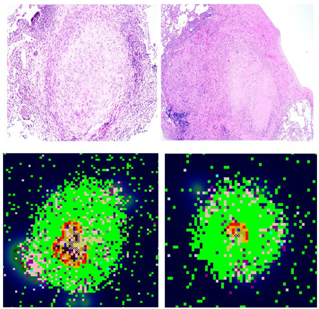 granuloma models Non-human primate TB granulomas with corresponding computer models