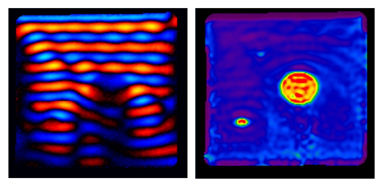 Description of magnetic resonance elastography (MRE) technique Description of magnetic resonance elastography (MRE) technique