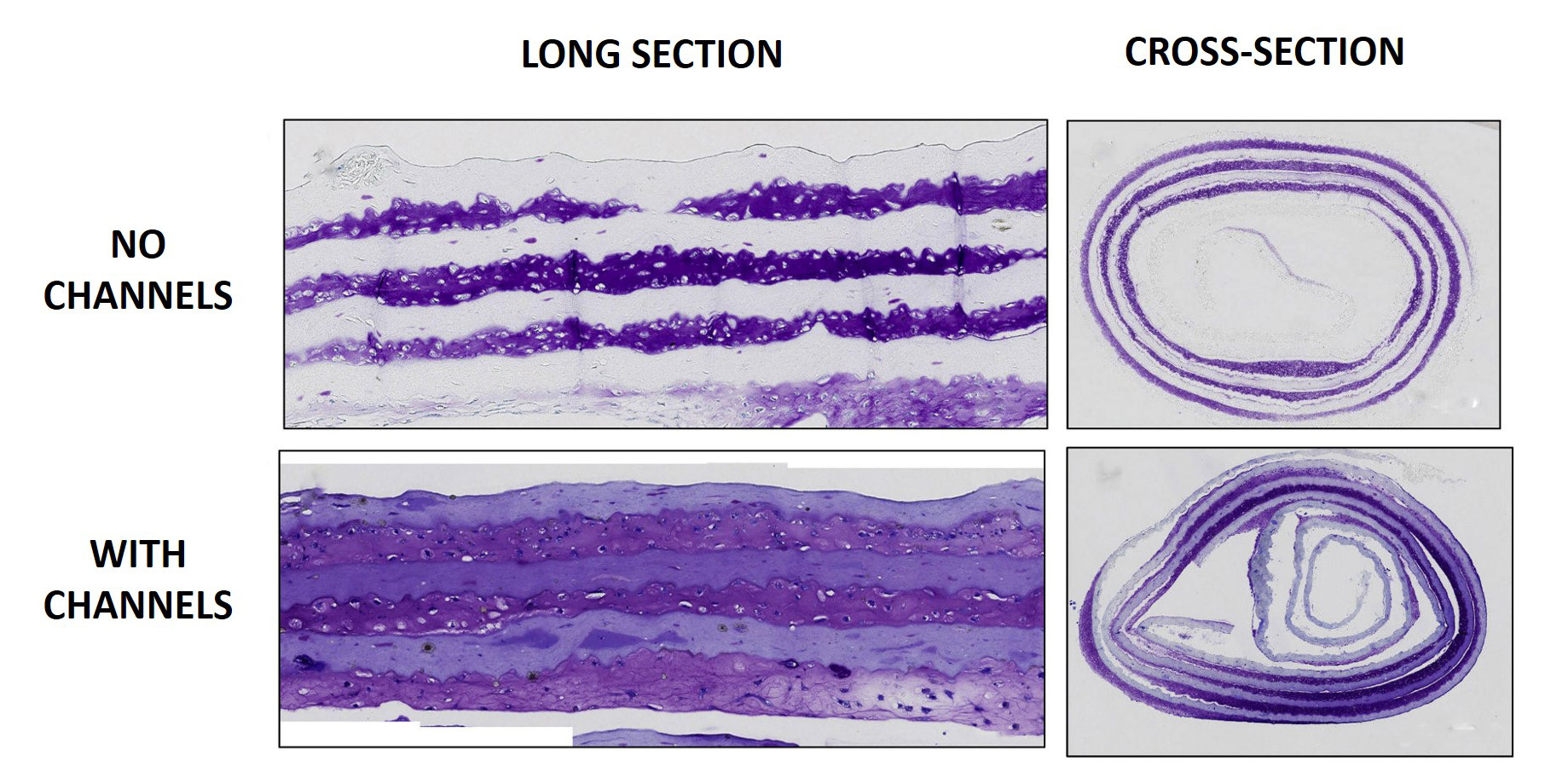 seeded scaffolds with and without channels