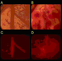 La lipoesferas marcadas fluorescentemente circulan por los vasos sanguíneos en una membrana transparente. La imagen al microscopio que aparece en la parte superior izquierda muestra un vaso sanguíneo antes de que un tren de impulsos de ultrasonido fragmente las lipoesferas. La imagen superior derecha muestra los vasos sanguíneos tres minutos después del ultrasonido. Las dos imágenes inferiores se obtuvieron usando la señal fluorescente emitida por las lipoesferas. La imagen inferior izquierda muestra el vaso sanguíneo antes de la fragmentación y la imagen inferior derecha lo muestra tres minutos después del ultrasonido. En los estudios actuales, la secuencia de impulsos de ultrasonido rompe en pedazos las lipoesferas liberando el colorante que se adhiere después a la pared del vaso sanguíneo. Este método ofrece mayor precisión para la administración dirigida de fármacos. Los próximos estudios incluirán un fármaco en vez de un colorante. Imagen cortesía de Katherine Ferrara.