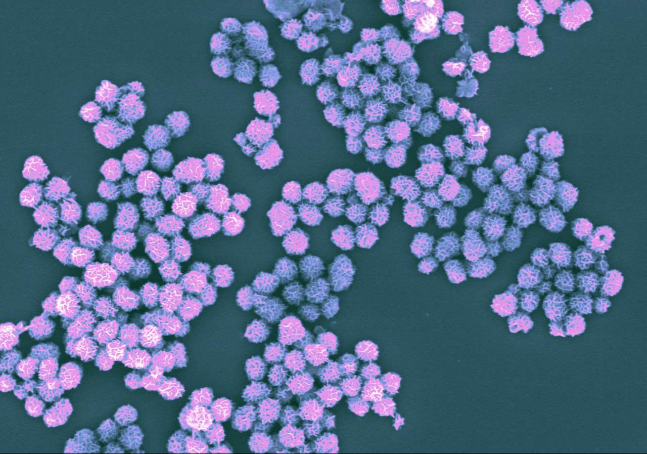 Imagen muy ampliada de muchos complejos nanovaccine