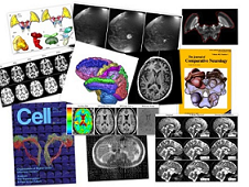 A collage of results using one of the many toolkits available on the open-access neuroinformatics clearinghouse, NITRC. A collage of results using one of the many toolkits available on the open-access neuroinformatics clearinghouse, NITRC.