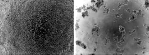 Cells killed by gene therapy technique