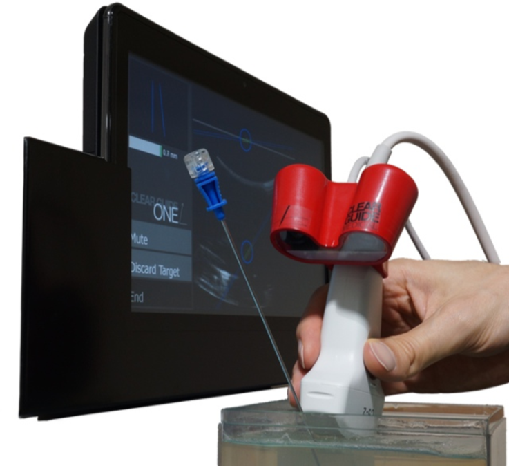 Clear Guide probe and touch screen