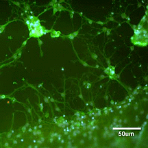 Células de ratones que crecen dentro de la estructura basada en nanofibras, desarrollada por los investigadores en la Northwestern University. La estructura contiene una alta densidad de IKVAV, una secuencia bioactiva compuesta por cinco aminoácidos derivados de la proteína extracelular denominada laminina. Aunque estas células tienen la capacidad de transformarse en diversos tipos de células, cuando son encapsuladas en esta matriz autoensamblable, la mayoría de ellas se convierte en neuronas, representadas en la figura en color verde. Los núcleos de las células están representados en color azul. La capacidad para controlar la diferenciación celular resulta interesante para el tratamiento de las lesiones de médula espinal ya que se podría utilizar la estructura para inhibir la formación de células no neuronales que forman el tejido cicatricial y evitan la recuperación. Foto cortesía de Dr. Samuel I. Stupp, Northwestern University.