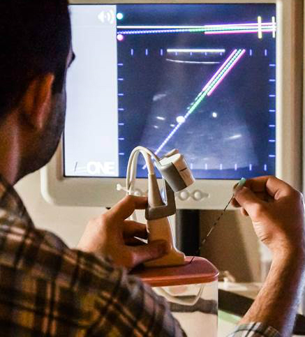 Operator using Clear Guide while watching ultrasound screen