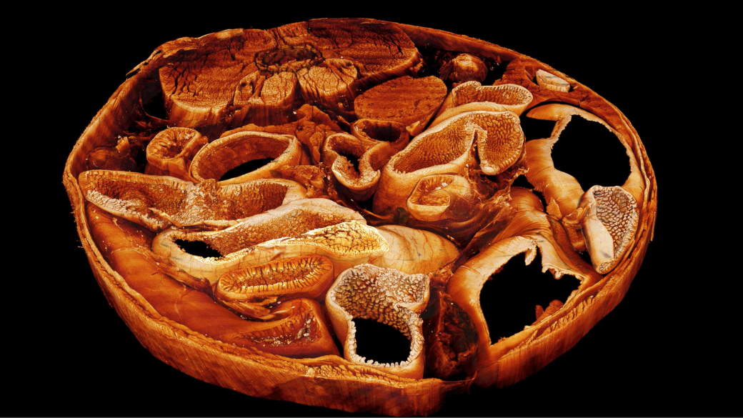 Intact peritoneal cavity as imaged using cleared tissue light-sheet microscopy and three-dimensional reconstruction Intact peritoneal cavity as imaged using cleared tissue light-sheet microscopy and three-dimensional reconstruction