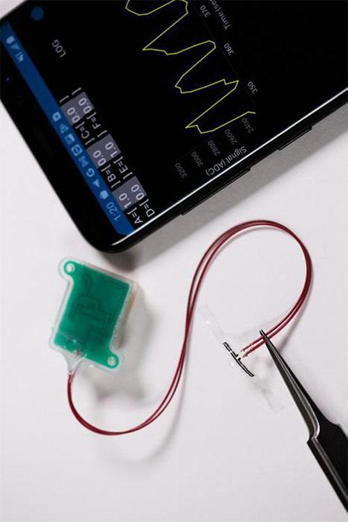 photo of smartphone app connected to bladder sensor
