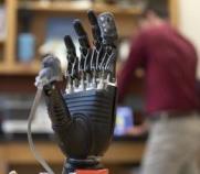 prosthetic hand with sensors for feeling
