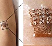 ultrasound patch on arm that measures blood pressure