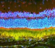 Protein expressed in the photoreceptors and retina of a rat. Image appears as fluorescent layers of red, purple, blue, yellow, and green.