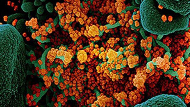 Covid Virus