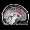 fMRI of blood in brain