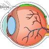 gene therapy for eye disease