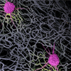 A medical illustration depicts two dendritic cells anchored to extracellular matrix. 