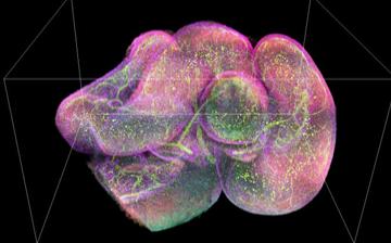 News & Events | National Institute of Biomedical Imaging and Bioengineering