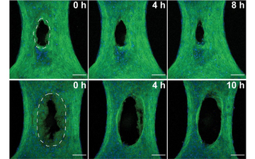 Six microscopic images show two injured microtissues over time. The top row depicts a knife wound immediately after the injury was created, and then at 4 and 8 hours after. The bottom row shows the laser wound immediately after the injury then the wound 4 and 10 hours after.  