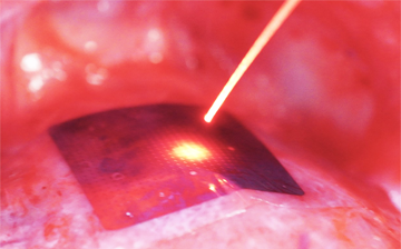 A photo of a thin silicon sheet on an animal heart being struck by a laser beam.