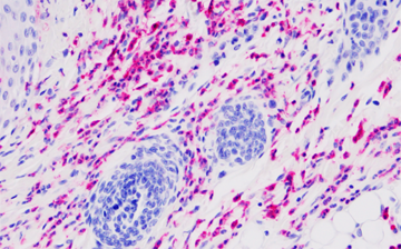 A histological image of mouse tissue stained for neutrophils