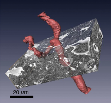 Image obtained using BEPS serial block face SEM