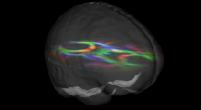 An image of a transparent brain with colored lines on axis