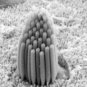 Image taken using scanning electron microscope