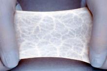 An image of two gloved hands stretching a blueish material with white lines all over it An image of two gloved hands stretching a blueish material with white lines all over it