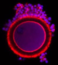 An image of a purple cell ringed in red with purple dots surrounding it. An image of a purple cell ringed in red with purple dots surrounding it.