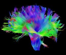 An image of a brain in the form of individual colored threads An image of a brain in the form of individual colored threads