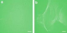 Two-step fluorescence microscopy comparison