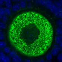 An image of an oocyte stained green to show an abundance of the Ronin protein