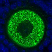 An image of an oocyte stained green to show an abundance of the Ronin protein An image of an oocyte stained green to show an abundance of the Ronin protein
